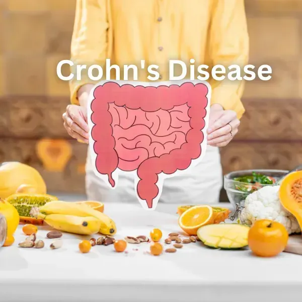 Crohn's Disease