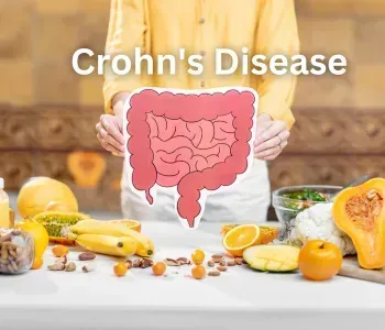 Crohn's Disease