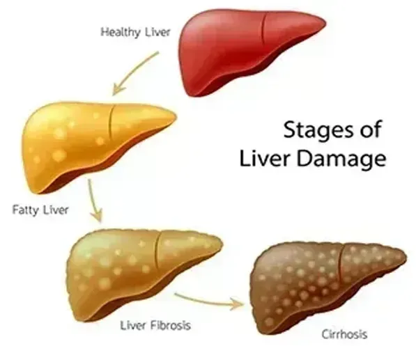 ALCOHOL METABOLISM