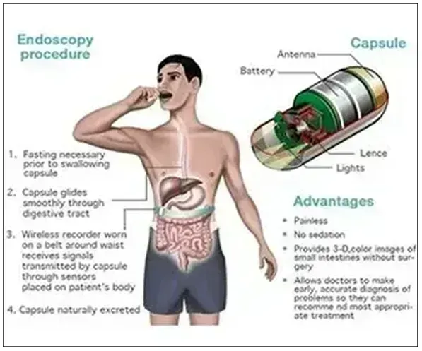 Capsule Endoscopy & SmartPill Capsule Studies