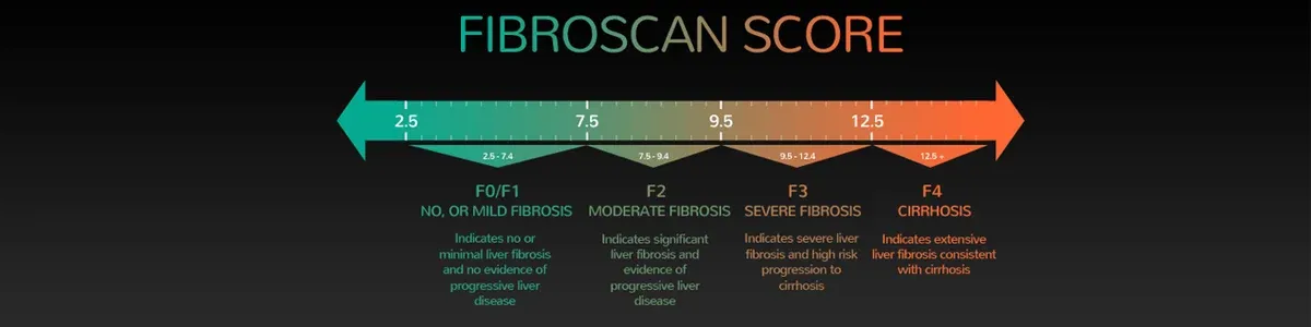 FIBROSCAN